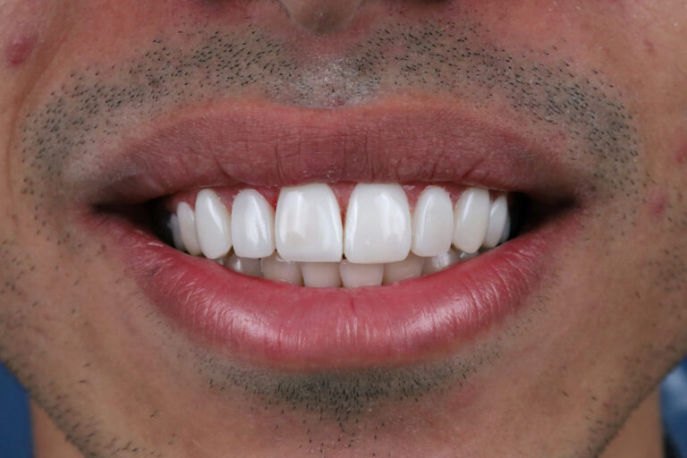 نمونه کار 6